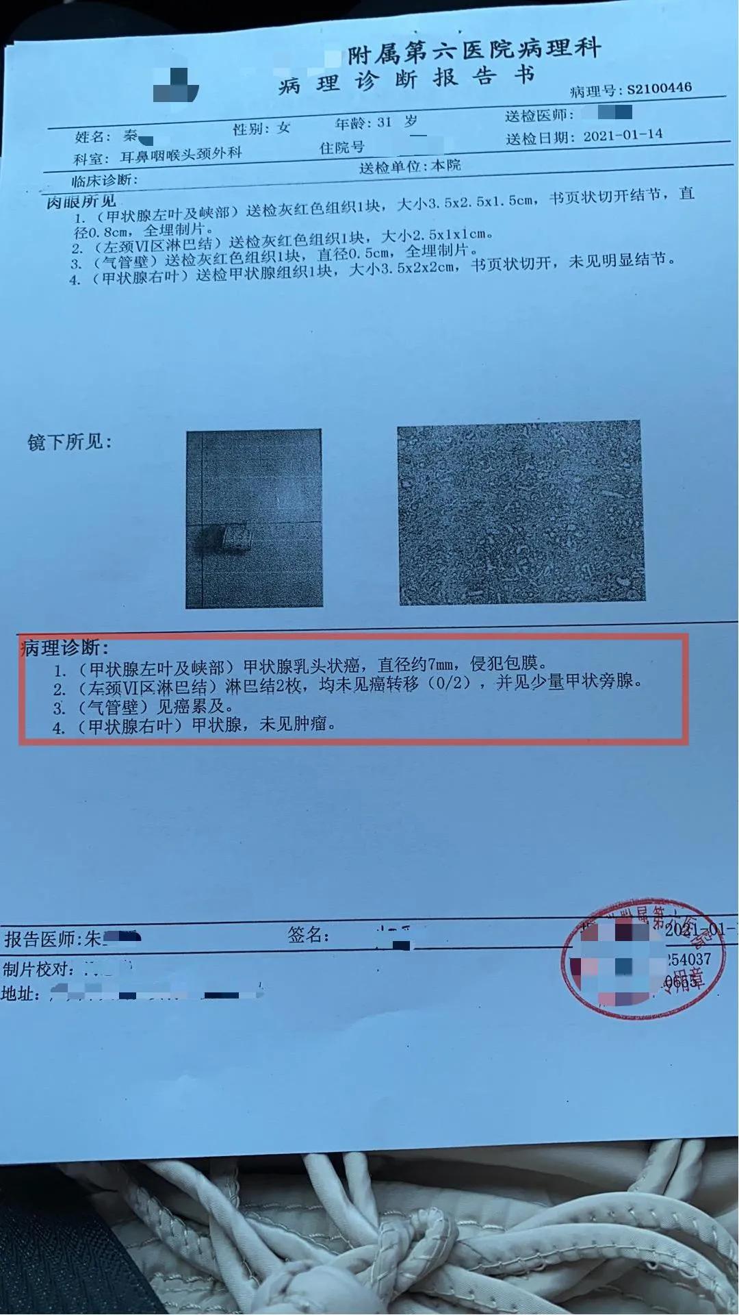 24岁女演员早咖晚酒确诊“癌王”年轻女演员的生命挑战，早咖晚酒与癌王的确诊故事